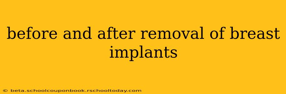 before and after removal of breast implants