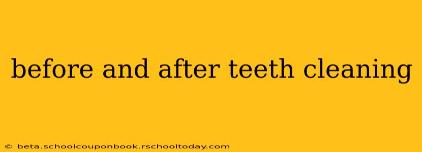 before and after teeth cleaning